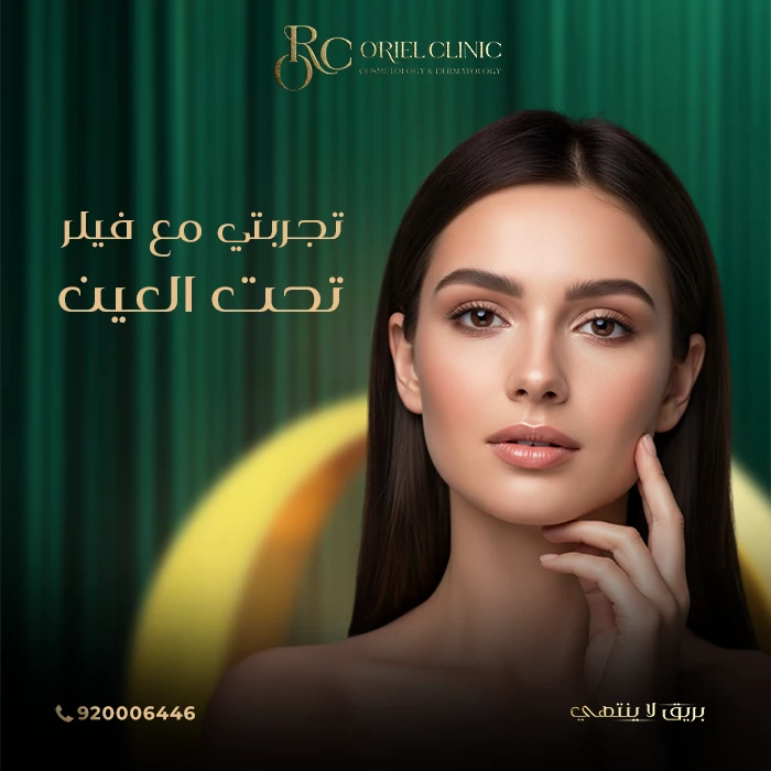 تجربتي مع فيلر تحت العين بالتفصيل