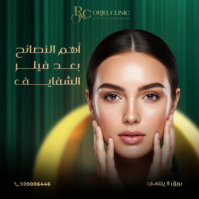 أهم النصائح بعد فيلر الشفايف