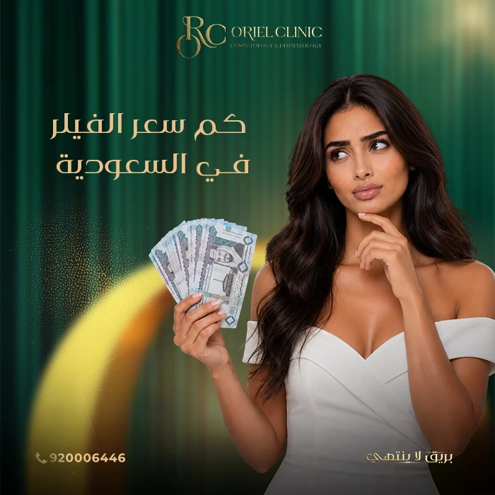 كم سعر الفيلر في السعودية؟