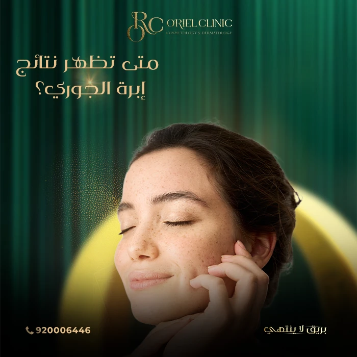 إبرة الجوري