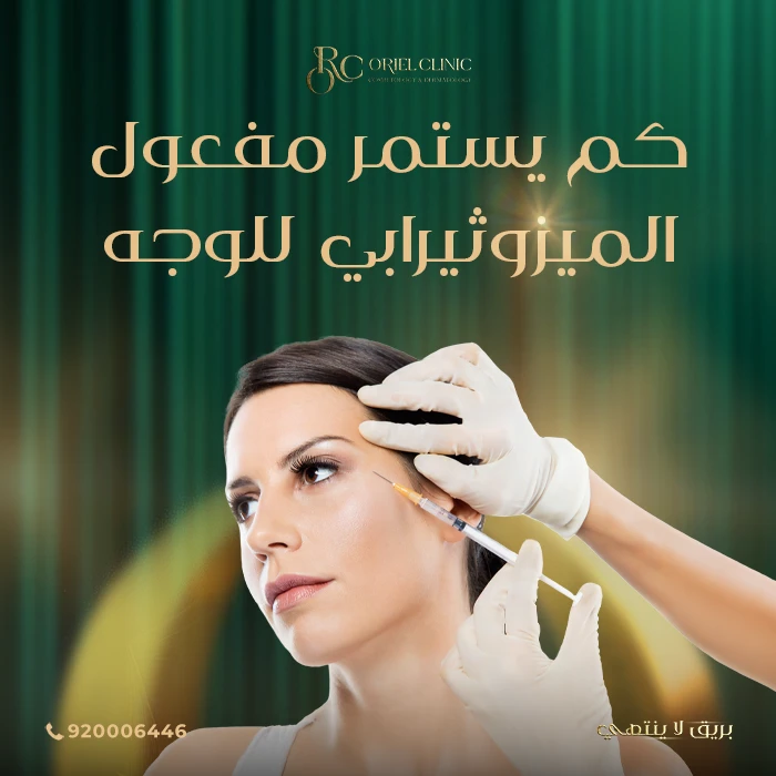 كم يستمر مفعول الميزوثيرابي للوجه؟